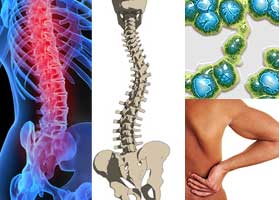 Лечение позвоночника в клинике Этианум Лечение позвоночника в клинике Этианум